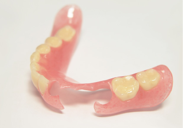 ノンクラスプデンチャー