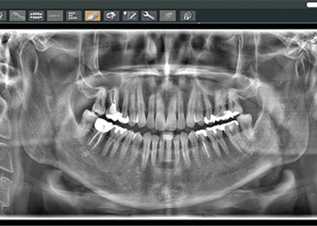 03.検査・レントゲン