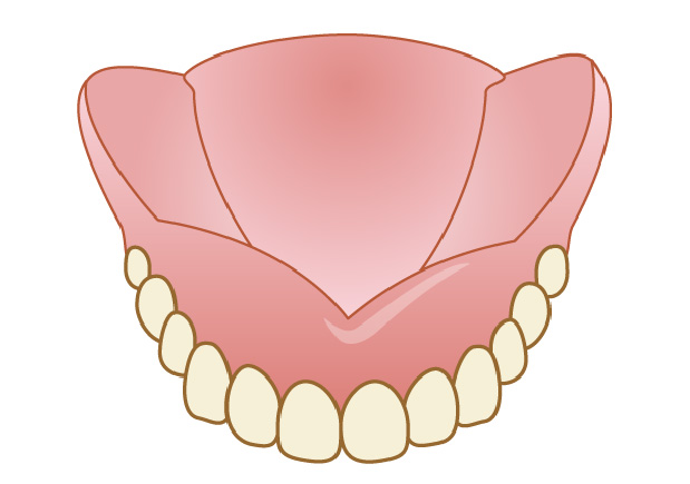 入れ歯の特徴