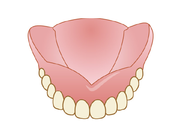 レジン床義歯（保険適用）