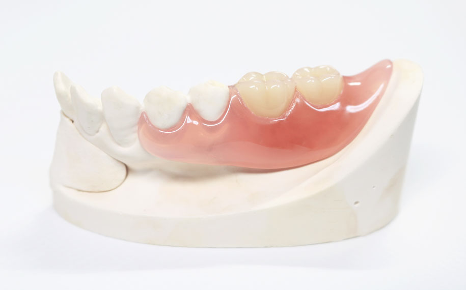 入れ歯は固くて痛いものだと思っていませんか？