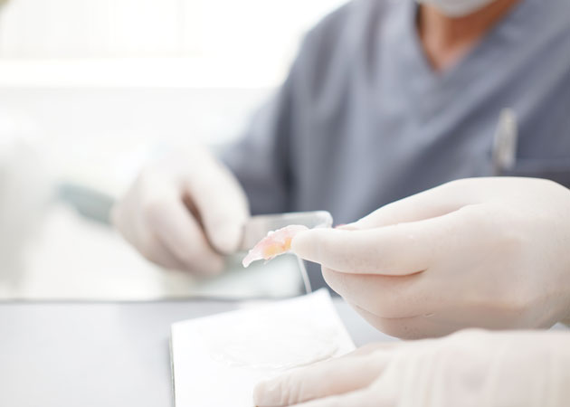 04.入れ歯の仮合わせ試適