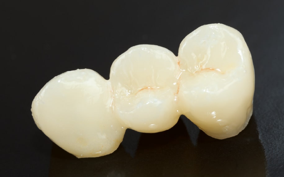 ブリッジの画像