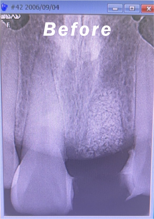 症例のbefore画像