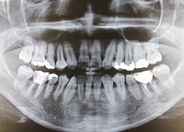 05.レントゲン撮影