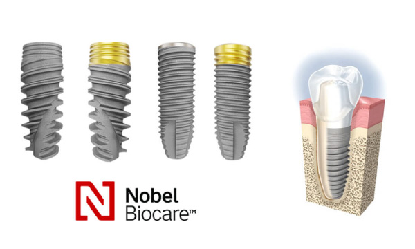 臨床経験25年のインプラント治療