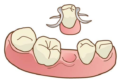 入れ歯治療